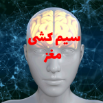 سیم کشی مغز