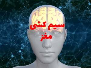 سیم کشی مغز